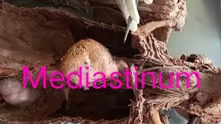 Anatomy of mediastinum. #mediastinum  #human  #dissection  #anatomy