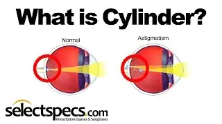 What is Cylinder in an Eyewear Prescription?  With SelectSpecs.com