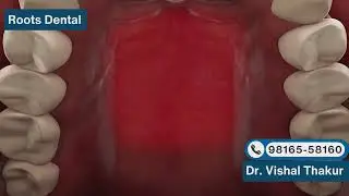 Oral cancer screening | Oral cancer awareness