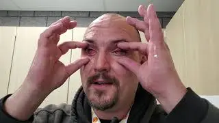 Alb NM Blind guy