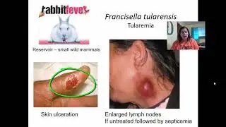 Chapter 23 Cardiovascular and Lymphatic Diseases