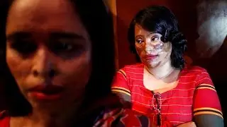 Acid attack survivors walk down the catwalk