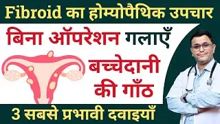 Uterine fibroid Homeopathic medicine Homeopathy treatment for Uterine Fibroids #RxHpathy
