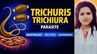Trichuris trichiura (Whipworm) | Morphology, Life Cycle & Lab Diagnosis हिन्दी में