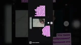 What is neuroline? Neurographics series. Что такое нейролиния?