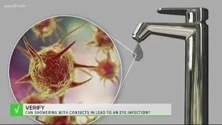 VERIFY: Yes, showering with your contact lenses in can lead to an eye infection caused by parasites