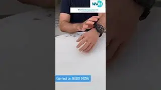 Silicone hand #artificiallimbs #artificialleg #ossur #iber #siliconehand #education #ytshorts #limbs