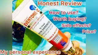 Eventone C Cream Honest Review | Results after one year | My personal experience