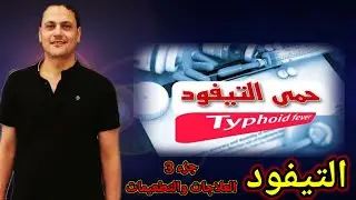 #حمي_التيفود تيفود  typhoid fever جزء 3 العلاج والتطعيمات