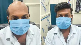 Hair patch  ଲଗାନ୍ତୁ  45 minutes ରେ new look ଫେରିପନ୍ତୁ//#ମାତ୍ର ୩୯୯୯/- ର🤙9861807187💗💗