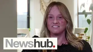 'Medication wrecked her life': How common topical eczema treatment led to addiction | Newshub