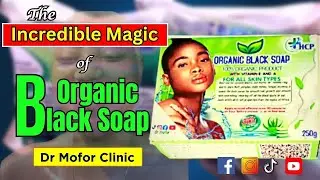 The incredible magic of organic black soap by Dr Mofor Clinic | Transform Your Skin Naturally