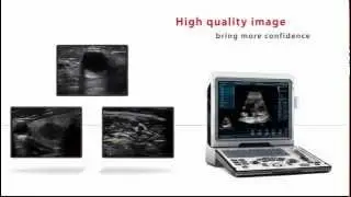 Mindray Digital Ultrasonic Diagnostic Imaging System DP-50