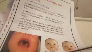 pediatric nursing unit nine{nursing care of child with congental anomalies} part one
