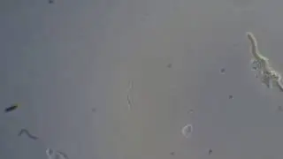Unidentified organism