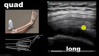 Introduction to Musculoskeletal Ultrasound