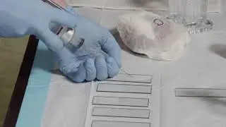 Fine Needle Aspiration Biopsy (FNA) Techniques - Smear Preparation