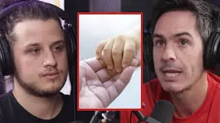 LA HISTORIA DE LA ADOPCION DE MAURICIO OCHMANN
