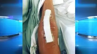 Opiate-Free Pain Management Options