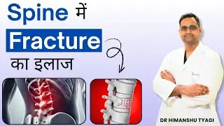 Spine में Fracture का इलाज | Causes, Symptoms & Treatment | Dr Himanshu Tyagi