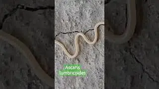 female ascaris lumbricoides live organism