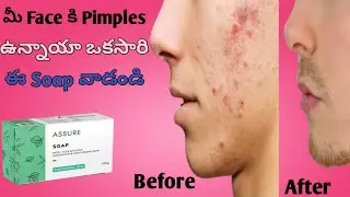 vestige assure soap benefits