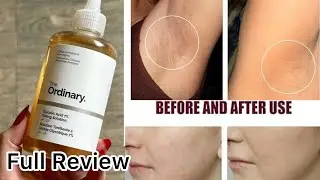 The Ordinary Glycolic Acid 7% Exfoliating Toner Honest Review | How to Use | #glycolicacid