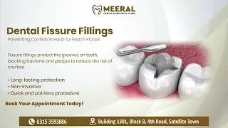Dental Fissure Filling | Protect Your Teeth  #fissure ##Filling #healthyteeth #CavityPrevention