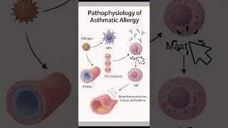 Asthmatic Allergy #pathophysiology,Causes & Immune Response #medical education.