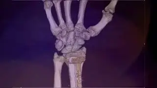 GDG CT3 High Definition Volumetric Imaging