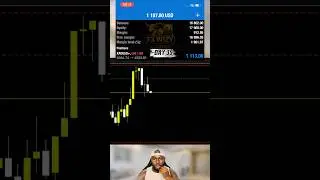 Taking Losses Like a Pro | Staying Disciplined 👀