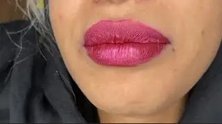 Lips,teeth,smile closeup || Smile Makeover