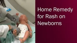How to treat a diaper rash