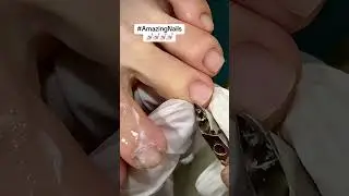 Cuticle & Nail Corner Care 👍 #trending #nails #amazing #relaxing #cleaning 