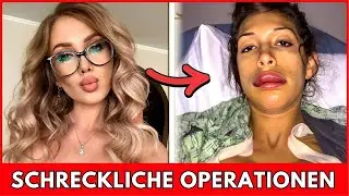Top 7 Prominente mit den SCHLIMMSTEN Sch&ouml;nheitsoperationen | Vorher & Nachher