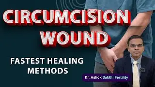 Fastest Healing Tips for Circumcision Wounds | Expert Care & Recovery Guide - Dr Ashok