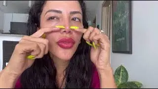 All I have done and spent in plastic surgery 😱