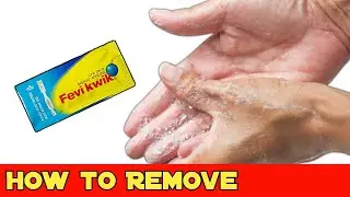 Feviquick Remover From Hand | How To Remove Feviquick From Hand