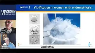 Сохранение продуктивности и эндометриоз