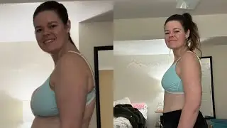 I look a bit different now (breast reduction process)