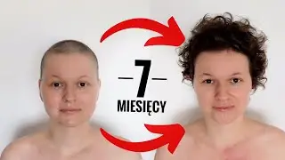 💛 WŁOSY 7 MIESIĘCY PO CHEMIOTERAPII 💛