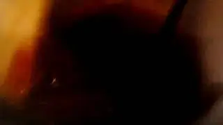 Eating dead body
