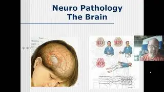 Med Careers Nervous System Lect #4