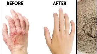 What Is BENTONITE CLAY | TOP 10 BENEFITS & HOW TO USE BENTONITE CLAY