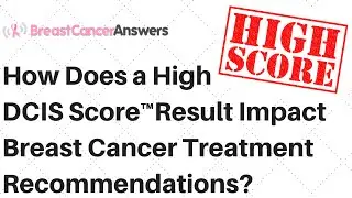 How Does a High DCIS Score Result Impact Your Treatment Recommendations?