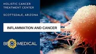 Relationship Between Cancer and Inflammation | Dr. Walter Kim at Brio-Medical Cancer Clinic
