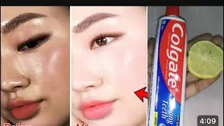 Colgate toothpaste for face whitening Lemon and colgate 1: Don't Skip Colgate Herbal Toothpaste#