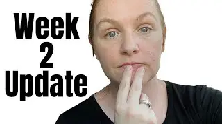 ОБНОВЛЕНИЕ: 2-я неделя приёма Strattera! ПОБОЧНЫЕ ЭФФЕКТЫ Strattera / МОЁ ПУТЬ БОРЬБЫ С СДВГ НА С...