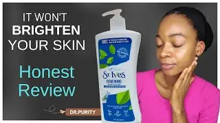 ST IVES BODY LOTION: HONEST & UNFILTERED REVIEW/ Best Hydrating Lotion #drpurity