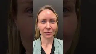 Miss, you forgot some... lip filler! 👄💉